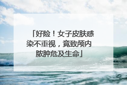 好险！女子皮肤感染不重视，竟致颅内脓肿危及生命
